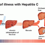 Ayudanos a correr la voz – Dia de la Hepatitis
