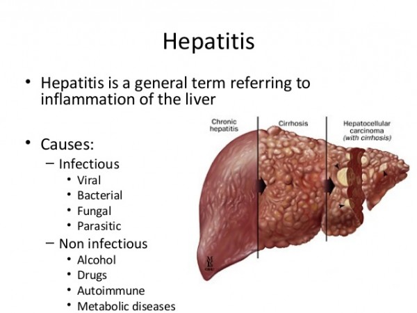laboratory-diagnosis-of-viral-hepatitis-b-c-2-638