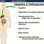 Cuantos tipos de hepatitis existen?