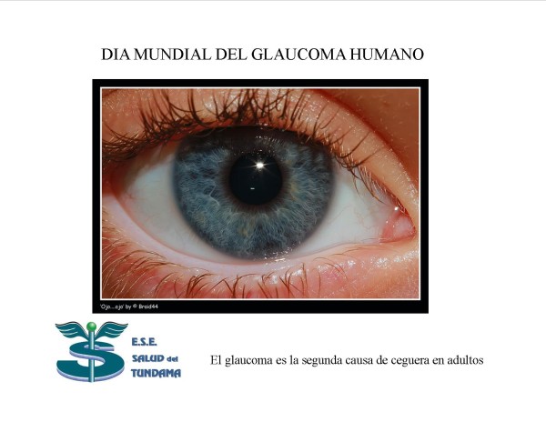 glaucomajpg.jpg10