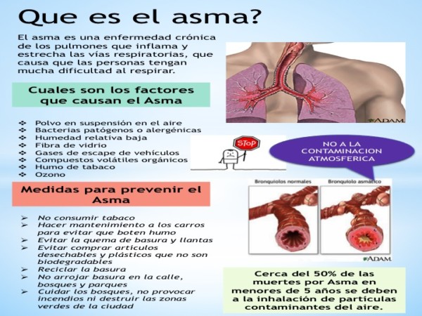 Cetosis para asma